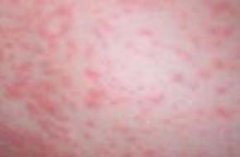 �������Ƥ�׵�ҽԺ